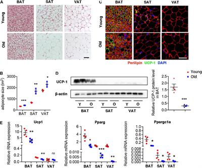 Senescent T Cell Induces Brown Adipose Tissue “Whitening” Via Secreting IFN-γ